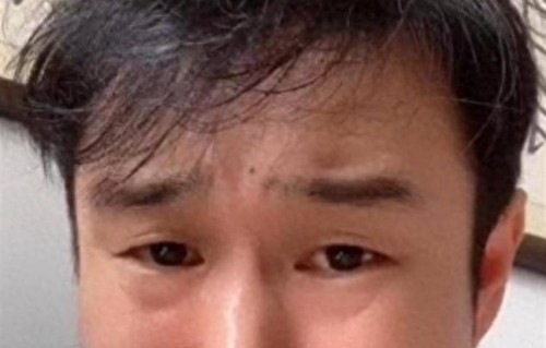 别再成为下个大S，45岁身体突发状况的小沈阳，给中年人提了个醒