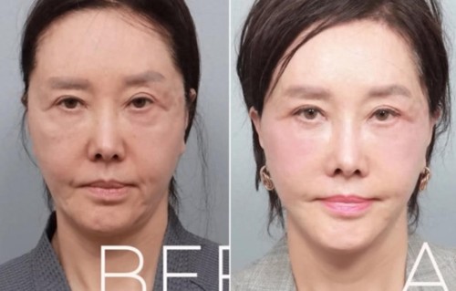 韩国女星罕见公开整容前后对比照，62岁仍然爱美，朋友直呼认不出 