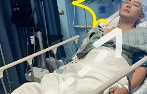 演员陈学冬：11部作品遭下架，两年4次手术，现35岁生活难以自理